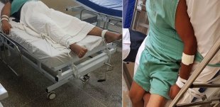 BARBÁRIE: pacientes com Covid em estágio grave são amarrados em macas por falta de sedativos