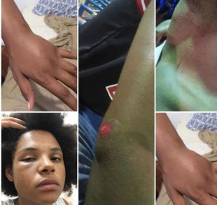 Jovens negros sofrem violência racista em bar da Pedra do Sal, no Rio de Janeiro